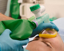 bagging_system_image